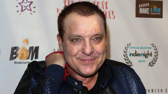 Tom Sizemore's management says there is no hope for the actor following a brain aneurysm.